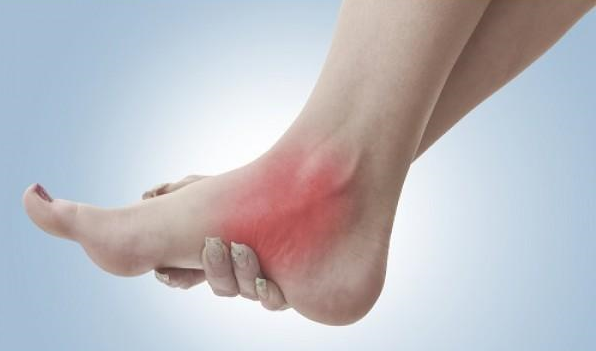 Home tarsal coalition