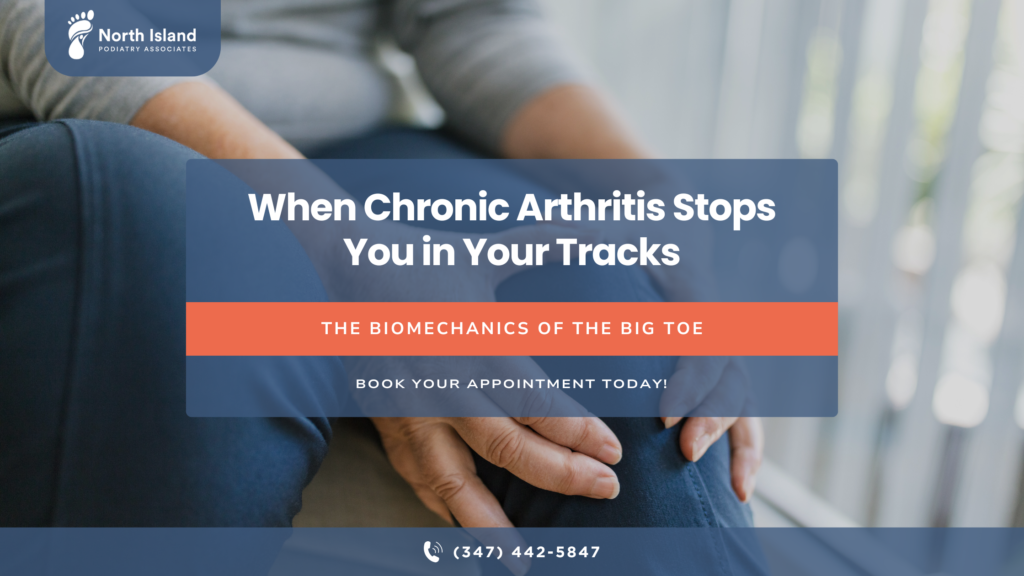 hallux rigidus when chronic arthritis stops you in your tracks