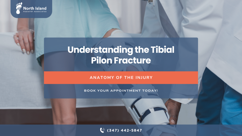 tibial pilon fracture why it’s more than just a broken leg