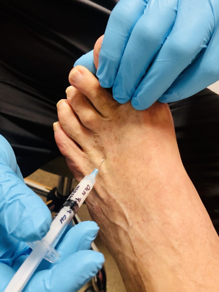 north island podiatry board certified podiatrist reviewing diabetic foot care plan with patient
