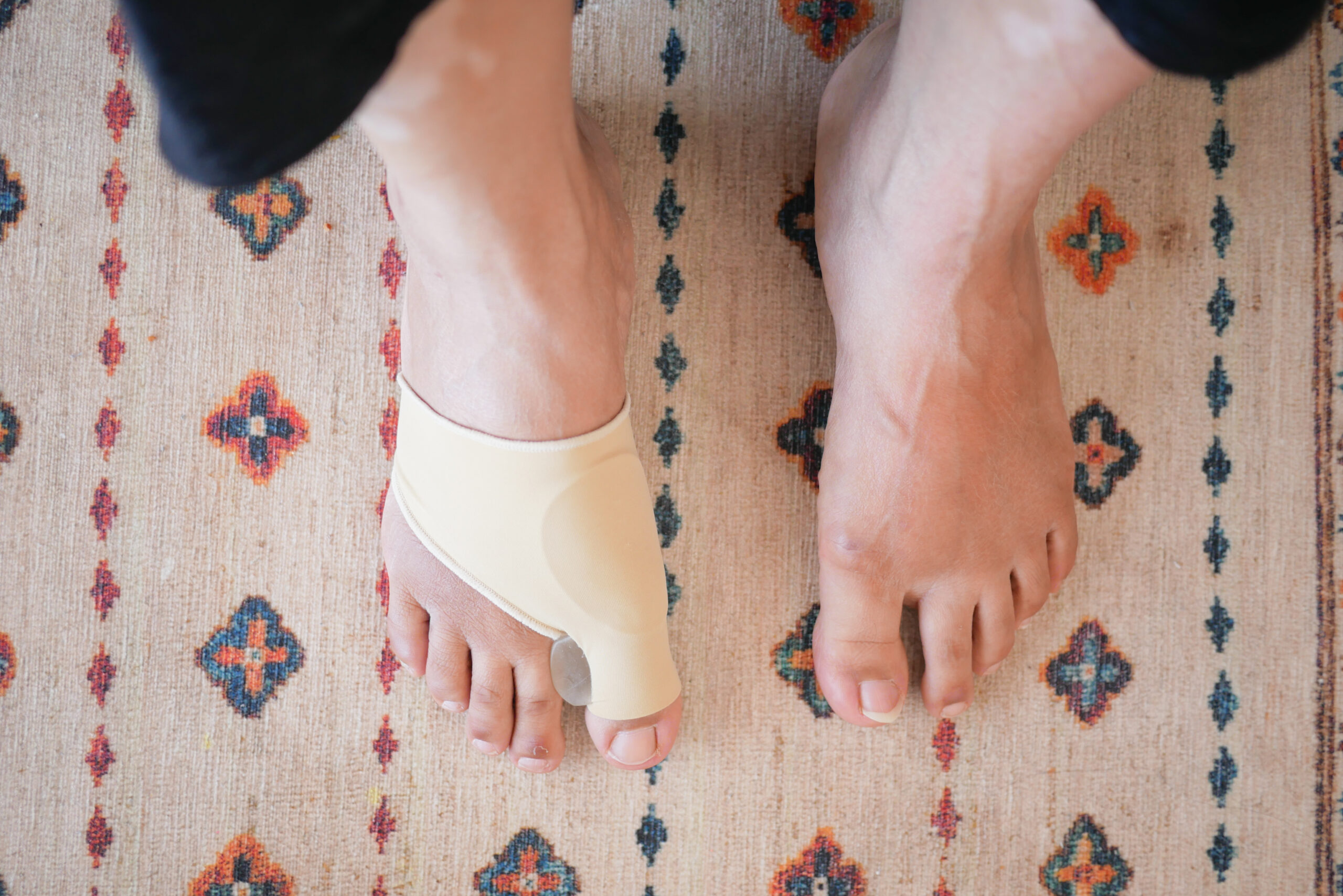 experience comfort by wearing a bunion corrector on your foot as you walk on the carpet