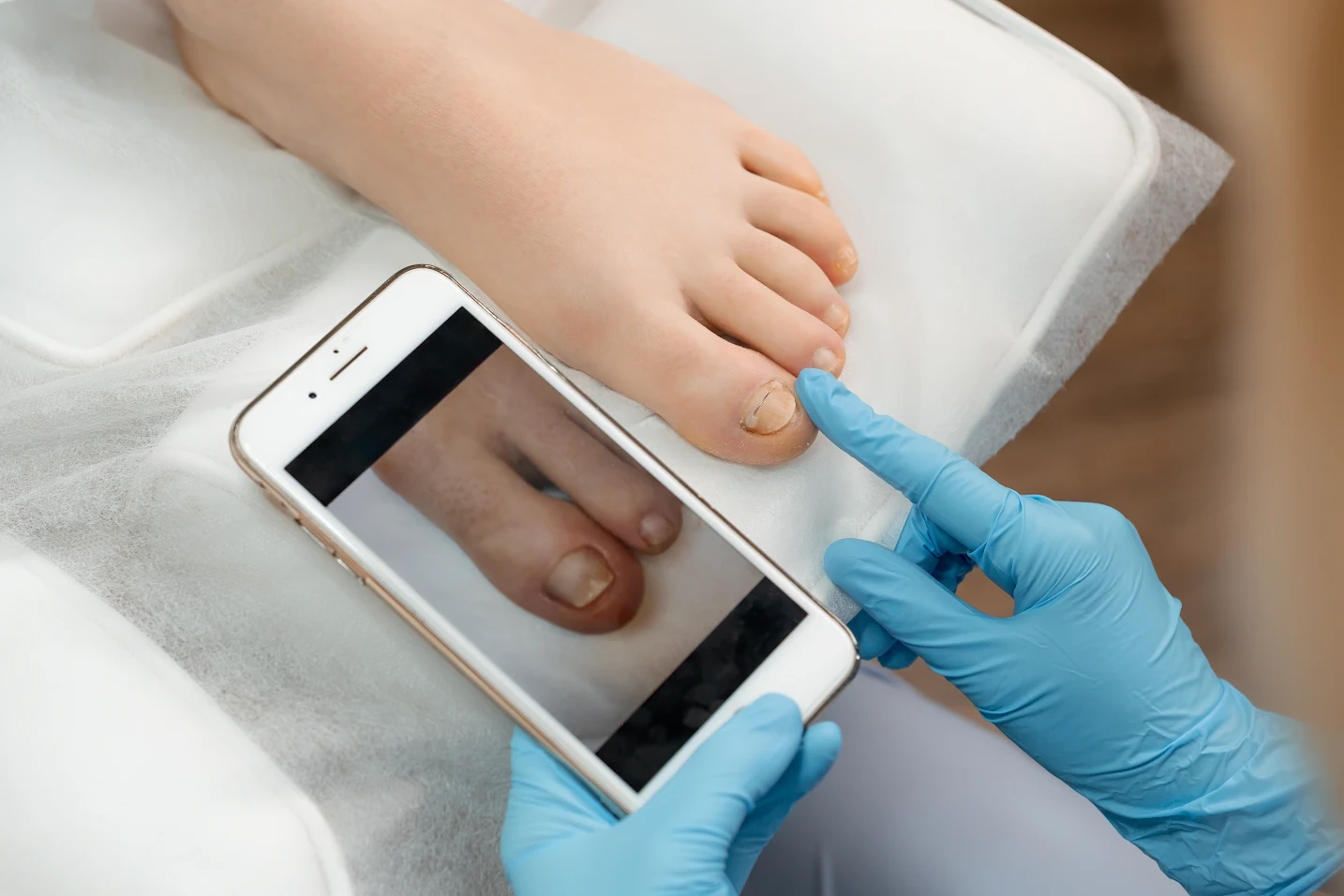 Diabetic Thumbnail